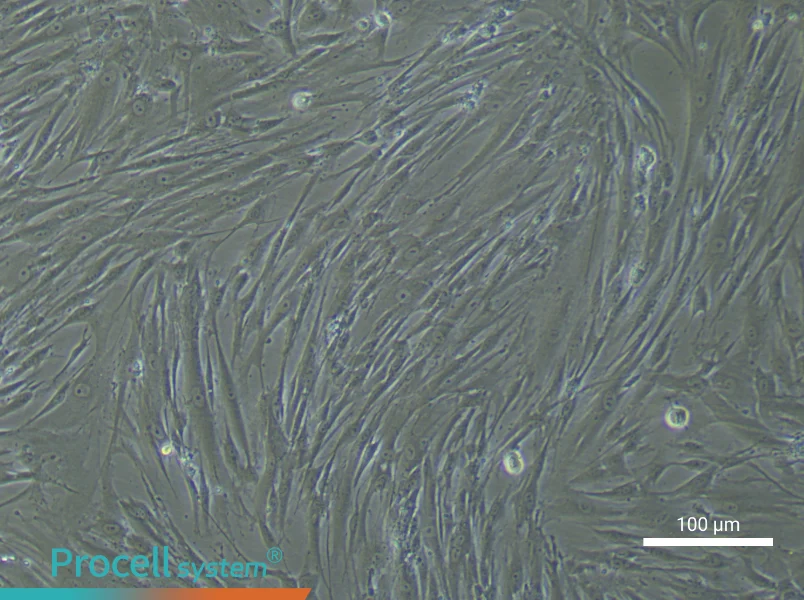 Human Periodontal Ligament Stem Cell Complete Medium - 3