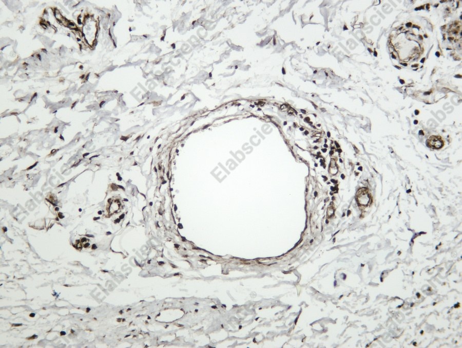 Recombinant Wnt5b Monoclonal Antibody - 2