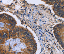FRK Polyclonal Antibody - 2