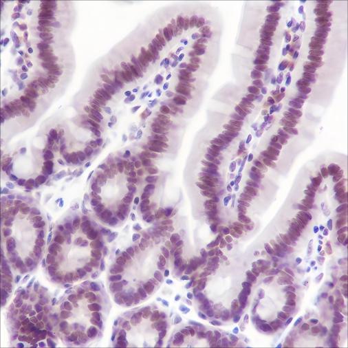 Recombinant SETD1A Monoclonal Antibody - small - 2