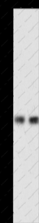 HAVCR1 Polyclonal Antibody - 1