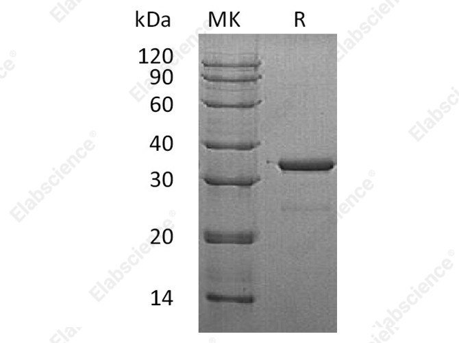 Recombinant Human SULT1A3 Protein (His Tag) - 1