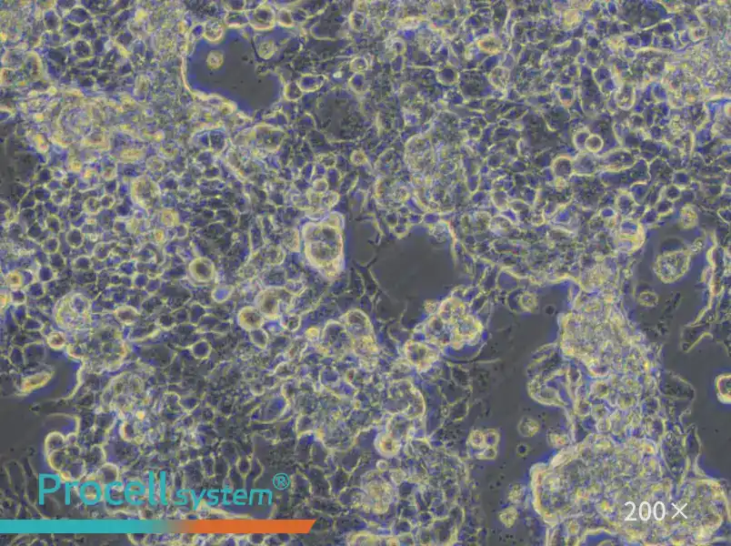 KM12 Cell Complete Medium - 6