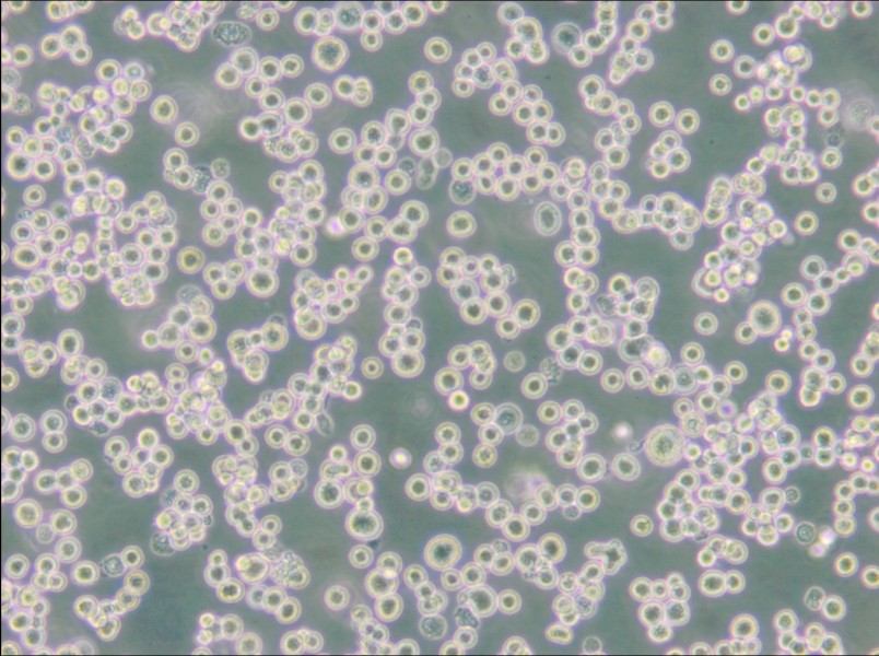 LLC-WRC 256 [Walker 256] Cell Complete Medium - 5