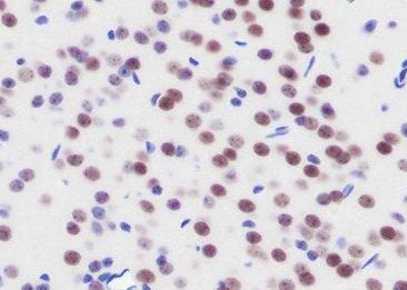 Recombinant PBX1 Monoclonal Antibody-searchlist-2