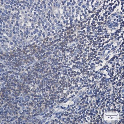 Recombinant BIN1 Monoclonal Antibody - 4