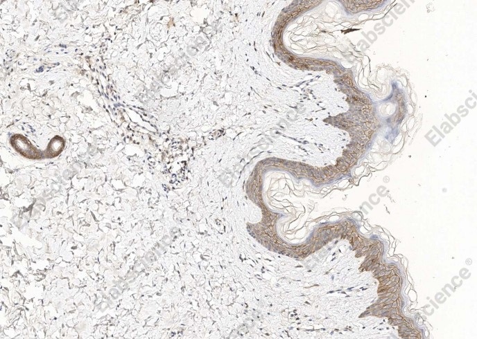 TROP2/TACSTD2 Monoclonal Antibody - 7