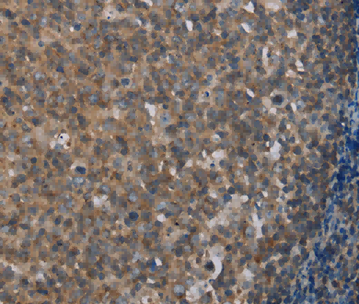 MMP20 Polyclonal Antibody - 2