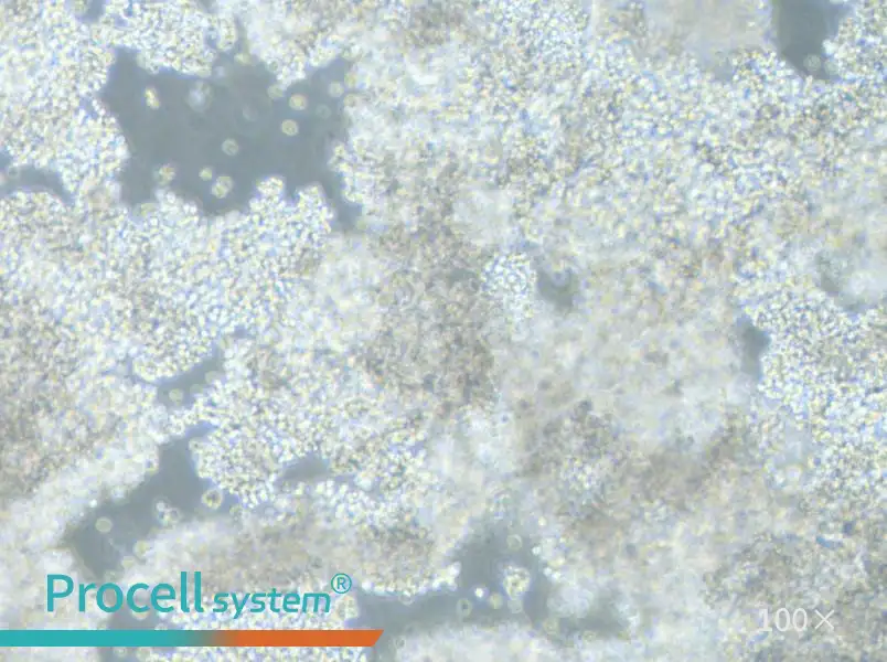 NCI-H2171 Cell Complete Medium - 1