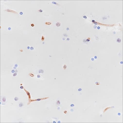 Recombinant Nestin Monoclonal Antibody-searchlist-1