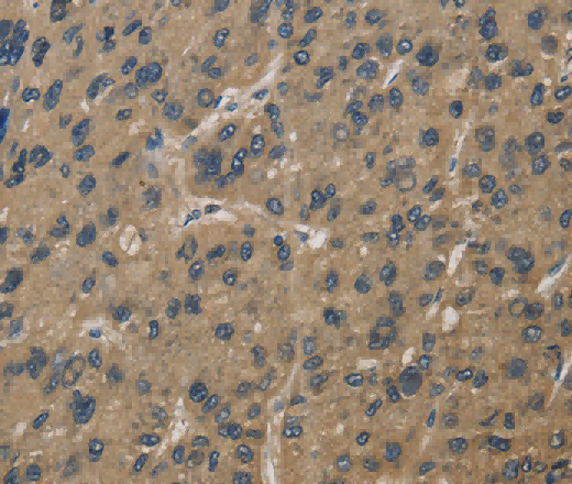CORO1C Polyclonal Antibody - 2