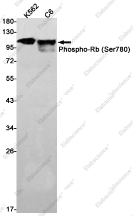 Recombinant Phospho-Rb (Ser780) Monoclonal Antibody - 1