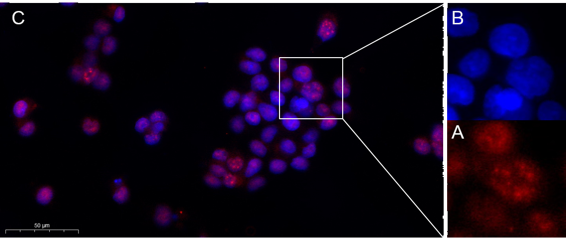 Recombinant Phospho-Akt (Thr308) Monoclonal Antibody - small - 5