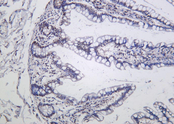 Recombinant Phospho-IκB-α (Ser36) Monoclonal Antibody-searchlist-1