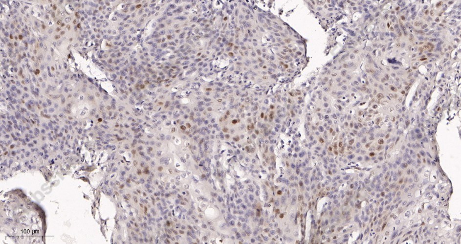 Recombinant p21 Monoclonal Antibody - 2