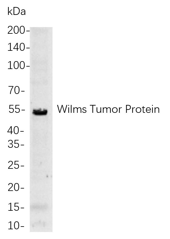 Recombinant Wilms Tumor Protein Monoclonal Antibody-searchlist-1