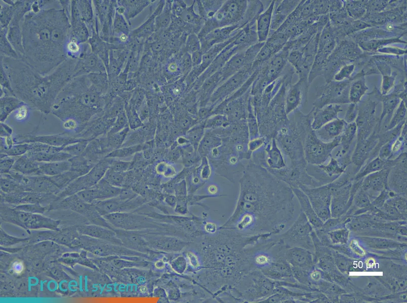 Rabbit Lung Fibroblast Complete Medium - 6