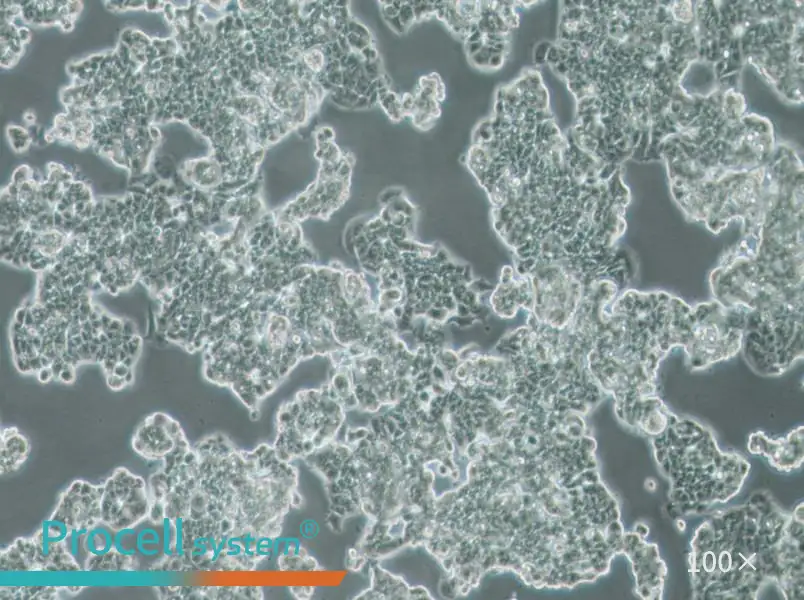 MCF7 [MCF-7] Cell Complete Medium - 3