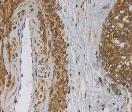 EMC8 Polyclonal Antibody - 2