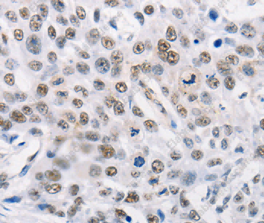 TRIM63 Polyclonal Antibody - 2