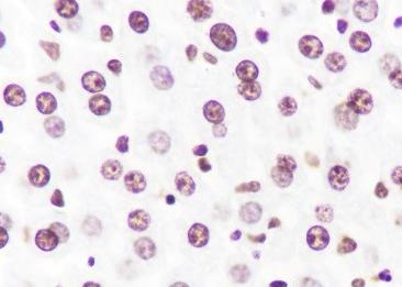 Recombinant Histone H3 (CT) Monoclonal Antibody-searchlist-1