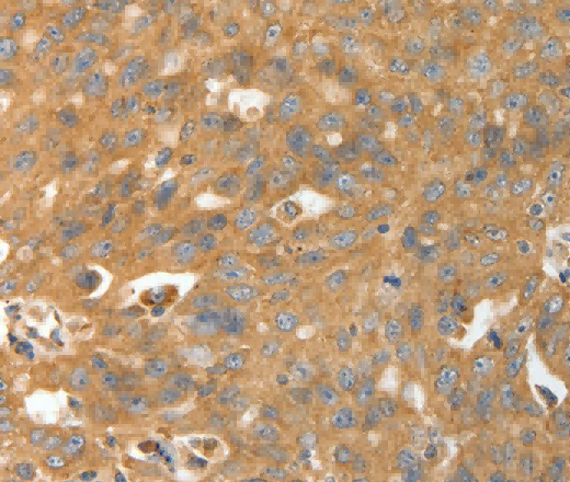 CALR Polyclonal Antibody - 2