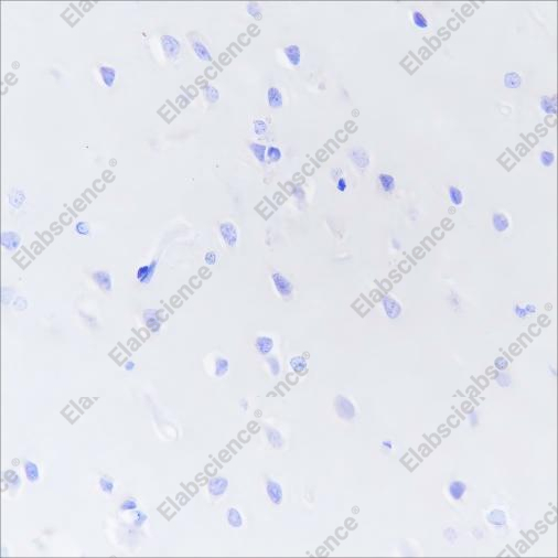 Recombinant DPEP1 Monoclonal Antibody - 1