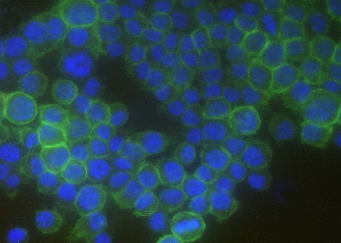Recombinant CD16-2/FCGR4 Monoclonal Antibody-searchlist-1