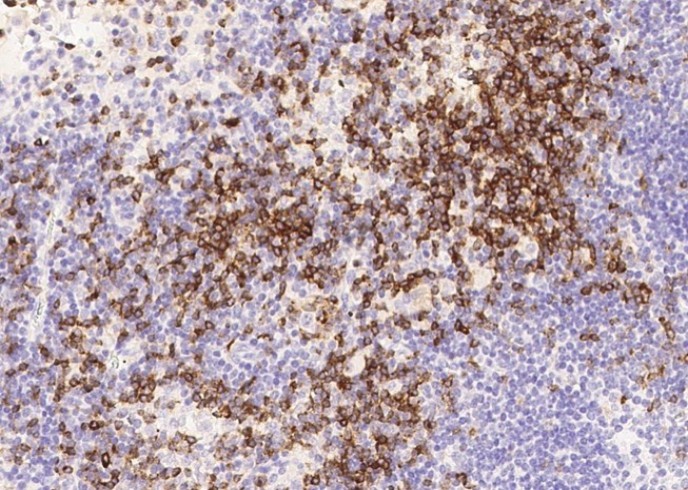 CD7 Monoclonal Antibody - small - 2