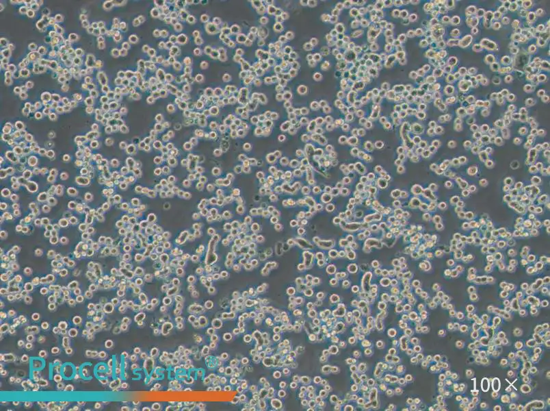 MDA-MB-134-VI (DMEM) Cell Complete Medium - 1
