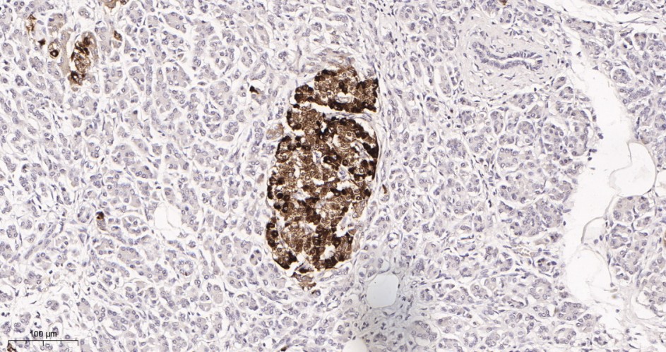 Recombinant Chromogranin A Monoclonal Antibody - small - 2