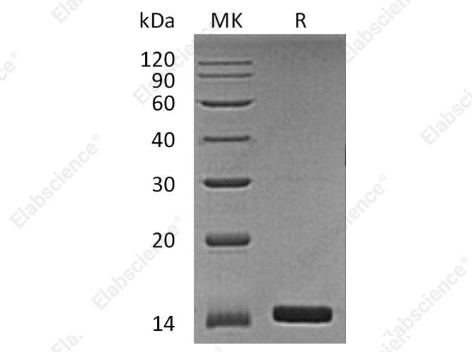Recombinant Human Angiogenin/ANG Protein - 1
