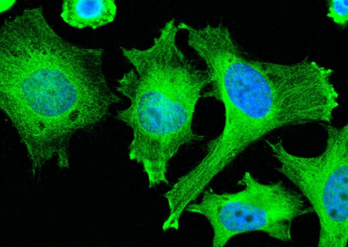 Recombinant ADSL/Adenylosuccinate Lyase Monoclonal Antibody - small - 2
