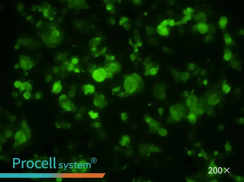 HePa1-6-GFP Cell Complete Medium - 2