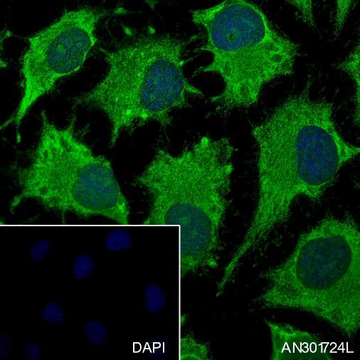 Recombinant SBDS Monoclonal Antibody - small - 6