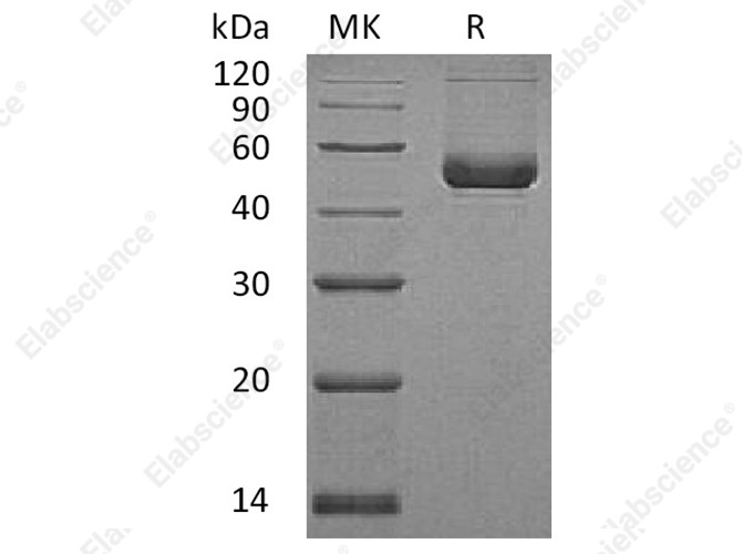 Recombinant Human SerpinE2/SERPINE2 Protein (His Tag) - 1