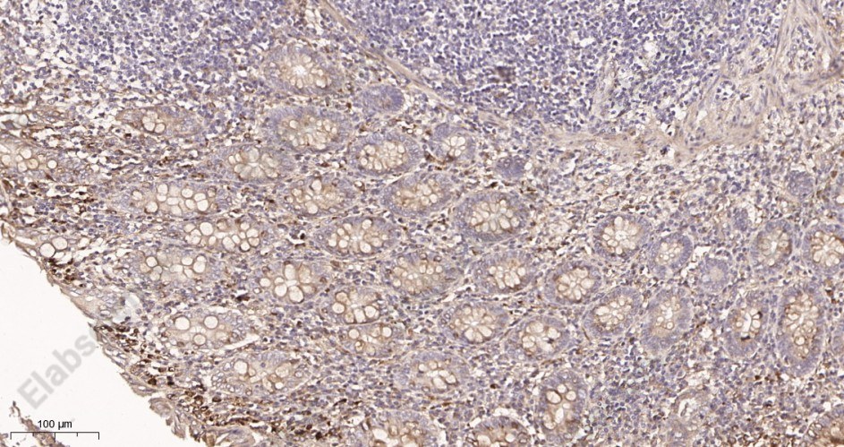 Recombinant Collagen IV Monoclonal Antibody - 2