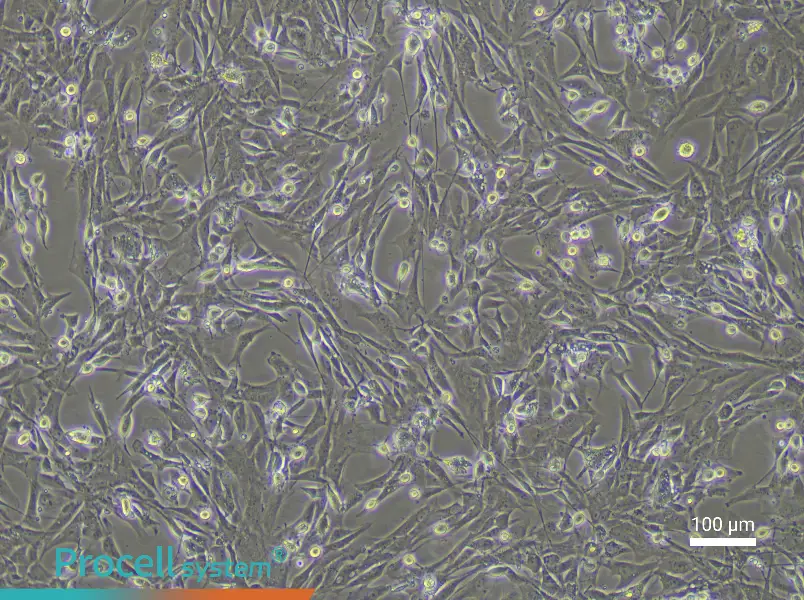 Rat Tracheal Fibroblast Complete MediumRat Tracheal Fibroblast Complete Medium - 2