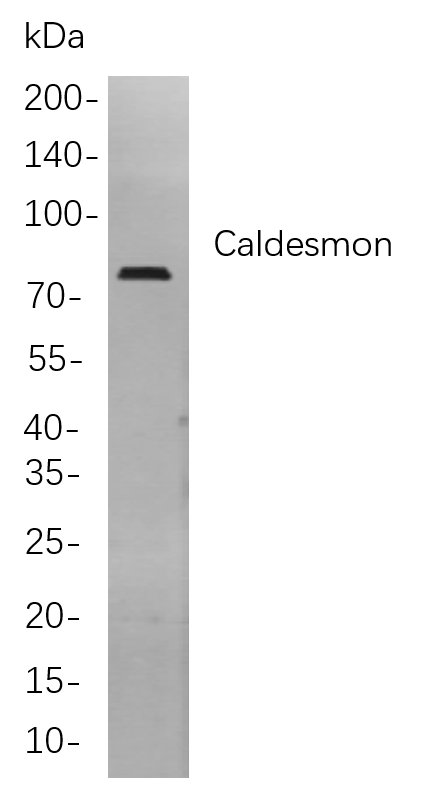 Recombinant Caldesmon Monoclonal Antibody-searchlist-1