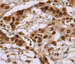 NUP50 Polyclonal Antibody - 3