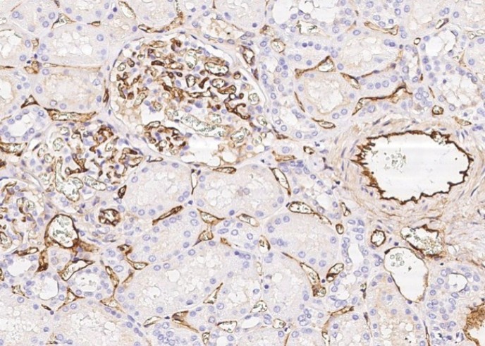 Recombinant Epcr/PROCR Monoclonal Antibody - small - 2