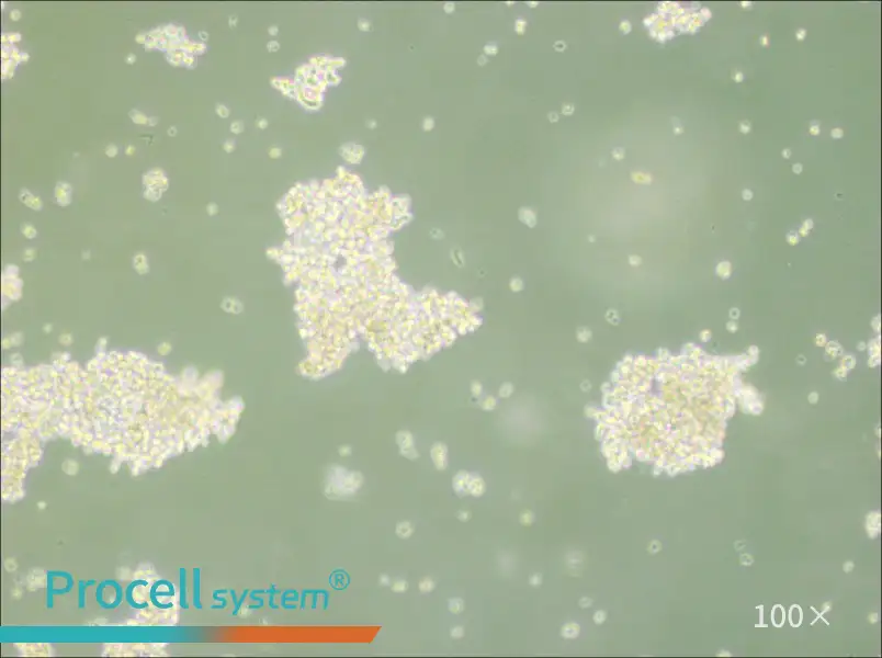 NCI-H69 Cell Complete Medium - 1