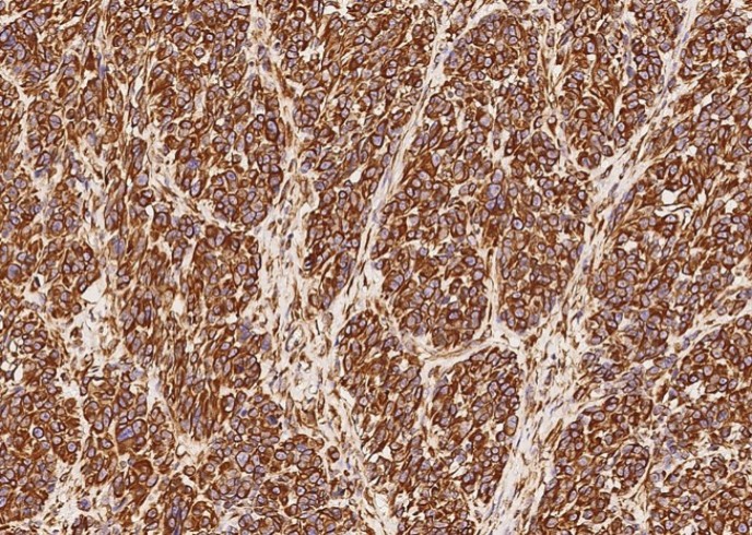 Recombinant Vimentin/VIM Monoclonal Antibody - small - 2