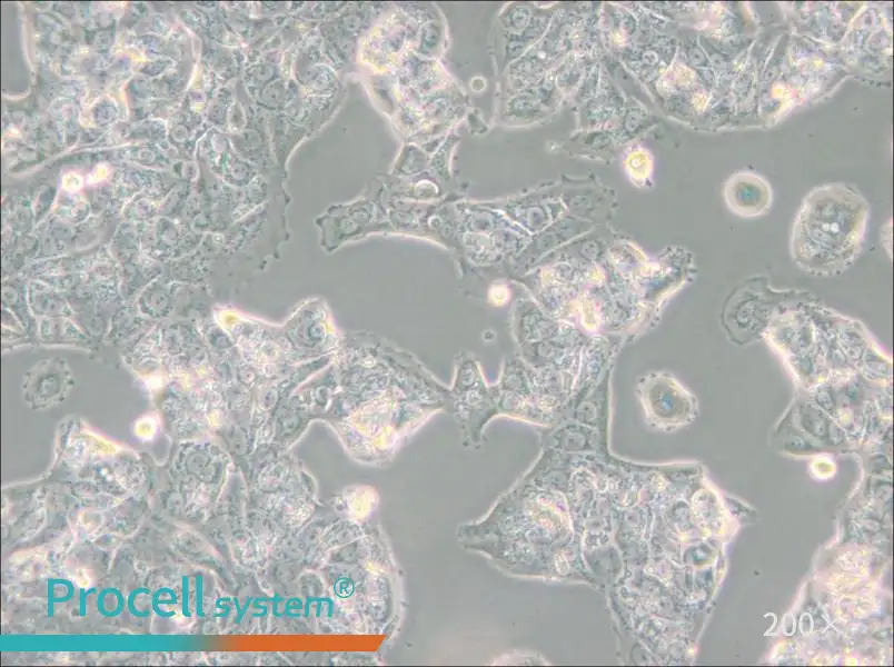 MDA-MB-175VII (DMEM) Cell Complete Medium - 6