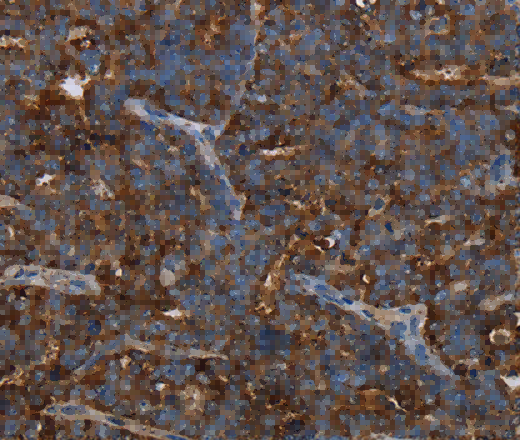 HMGCL Polyclonal Antibody - 2