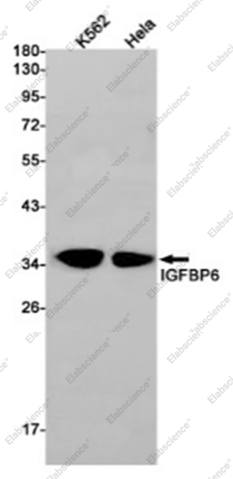 Recombinant IGFBP6 Monoclonal Antibody - 1
