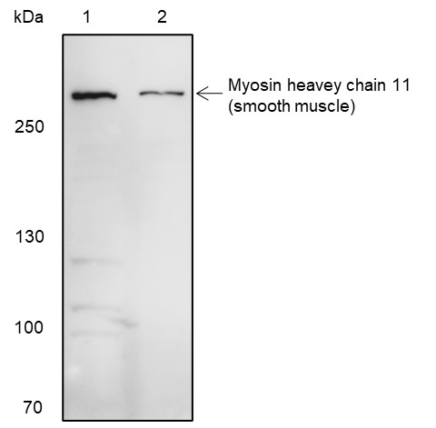 Recombinant Smooth Muscle Myosin heavy chain 11 Monoclonal Antibody-searchlist-1