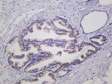 Recombinant NKX3.1 Monoclonal Antibody - 1
