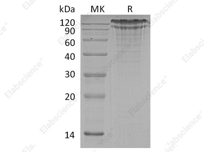 Recombinant Human LDLR Protein (His Tag) - 1