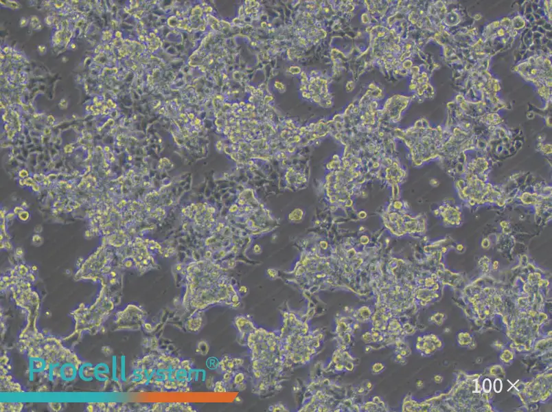 KM12 Cell Complete Medium - 1
